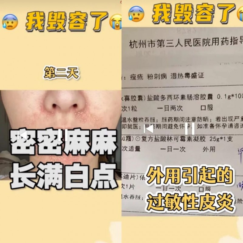 家暴电竞男示爱主持人？小霸宠疑似遇pua？前男友爆煎饺生图？小蛮过敏毁容？党妹卖写真翻车？