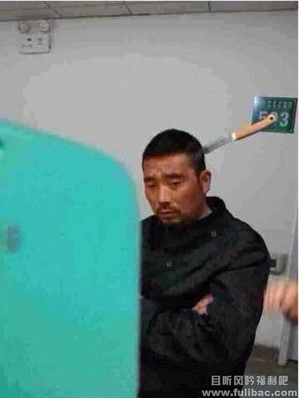 蛋定哥就医 男子头插水果刀就医被称蛋定哥